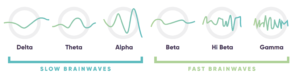 various brain waves diagrams are shown in an illustration. six brain waves are illustrated